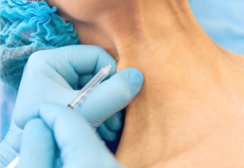 ботулінотерапія при кривошиї мігрені спазмі вінниця клініка метод лікування в неврології